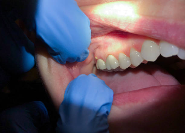 Best Emergency Dentist for Special Needs Patients in Stuttgt, AR